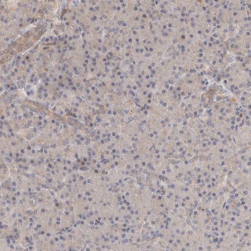 OTUD6B Antibody - BSA Free Immunohistochemistry-Paraffin: OTUD6B Antibody - BSA Free [NBP1-85651]