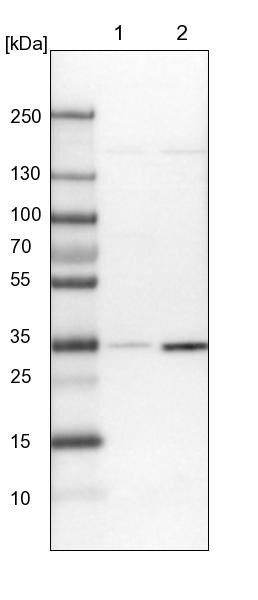 OTUD6B Antibody - BSA Free Western Blot: OTUD6B Antibody - BSA Free [NBP1-85651]