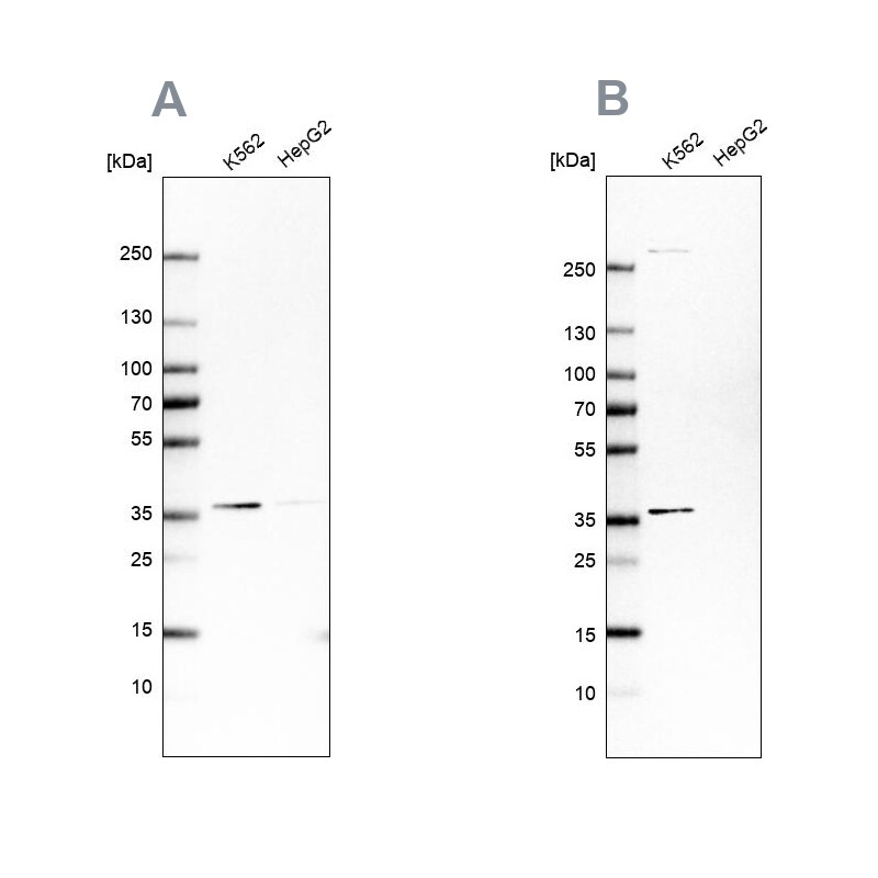 OTUD6B Antibody - BSA Free Western Blot: OTUD6B Antibody - BSA Free [NBP1-85652]