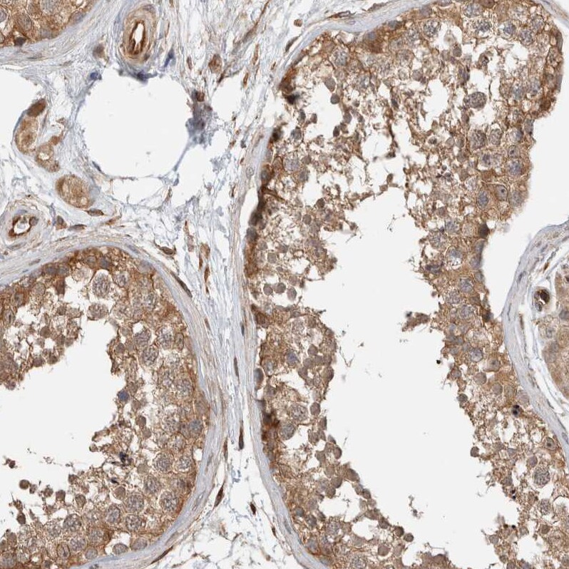 OTUD6B Antibody - BSA Free Immunohistochemistry-Paraffin: OTUD6B Antibody - BSA Free [NBP1-85653]