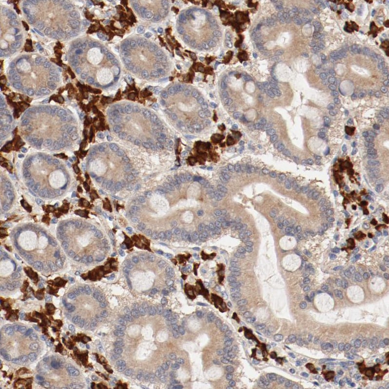 UBE2J1 Antibody - BSA Free Immunohistochemistry-Paraffin: UBE2J1 Antibody - BSA Free [NBP1-85654]