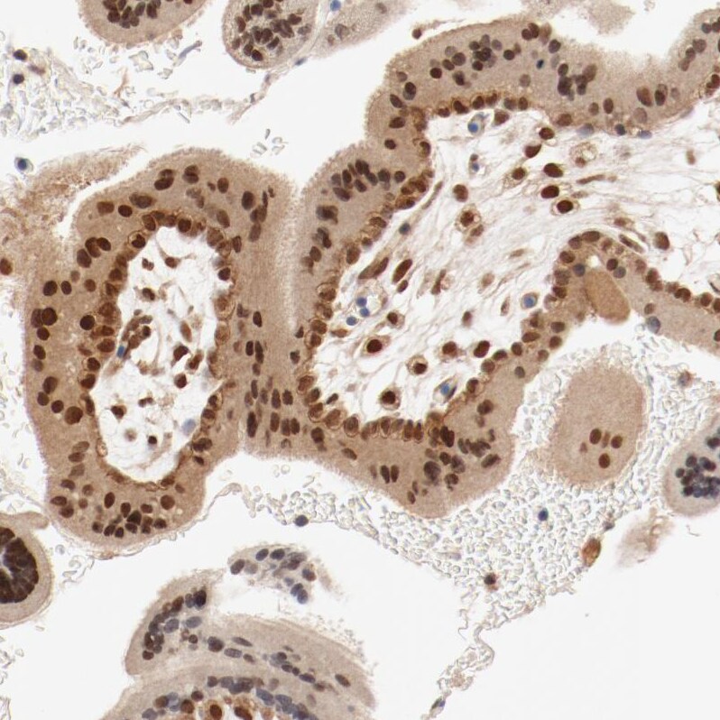UBE2J1 Antibody - BSA Free Immunohistochemistry-Paraffin: UBE2J1 Antibody - BSA Free [NBP1-85654]