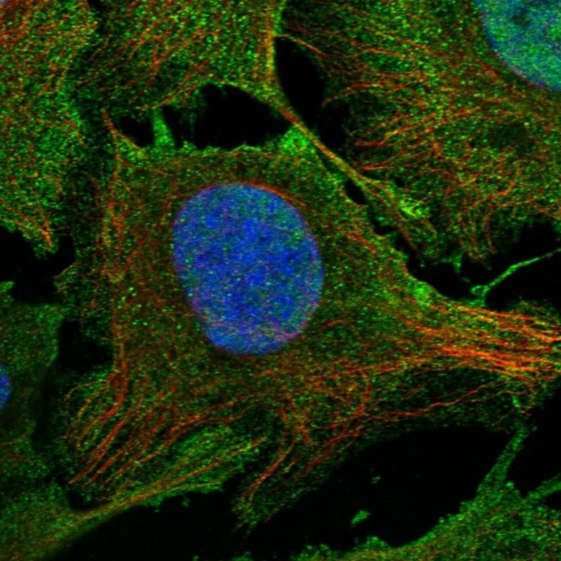 PHF20L1 Antibody - BSA Free Immunocytochemistry/ Immunofluorescence: PHF20L1 Antibody [NBP1-85655]