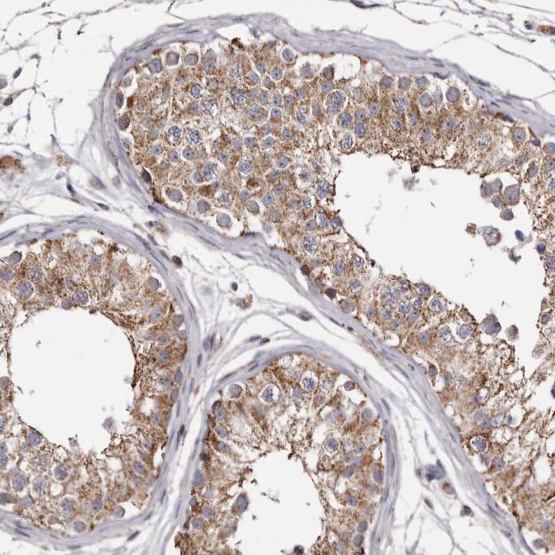 MECR Antibody - BSA Free Immunohistochemistry-Paraffin: MECR Antibody - BSA Free [NBP1-85657]