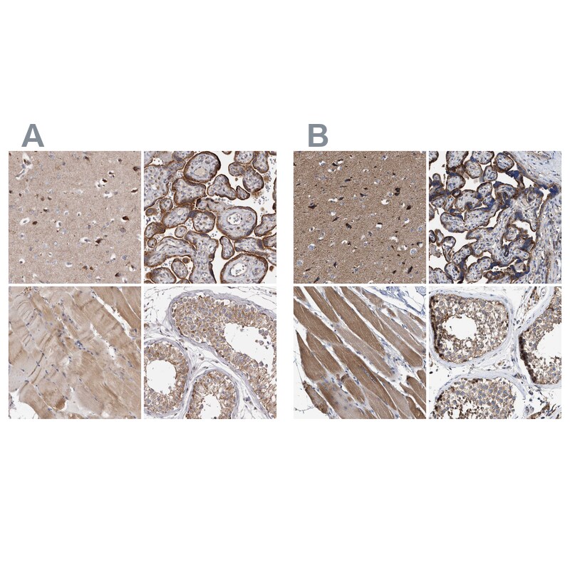 MECR Antibody - BSA Free Immunohistochemistry-Paraffin: MECR Antibody - BSA Free [NBP1-85657]