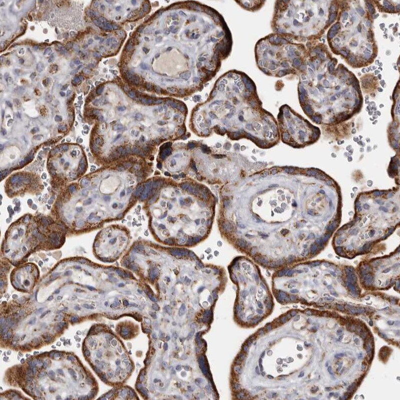 MECR Antibody - BSA Free Immunohistochemistry-Paraffin: MECR Antibody - BSA Free [NBP1-85657]
