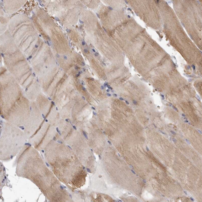 MECR Antibody - BSA Free Immunohistochemistry-Paraffin: MECR Antibody - BSA Free [NBP1-85657]