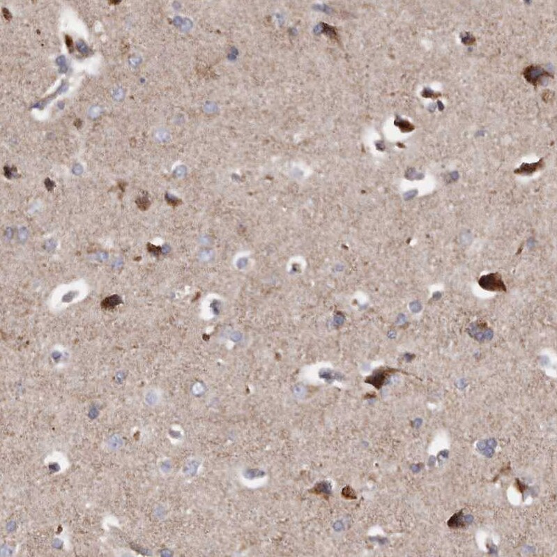 MECR Antibody - BSA Free Immunohistochemistry-Paraffin: MECR Antibody - BSA Free [NBP1-85657]