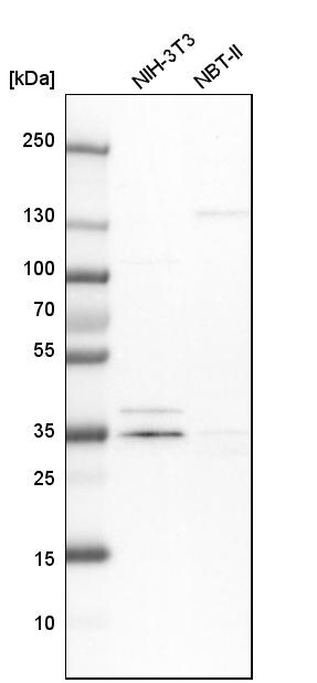 MECR Antibody - BSA Free Western Blot: MECR Antibody - BSA Free [NBP1-85657]