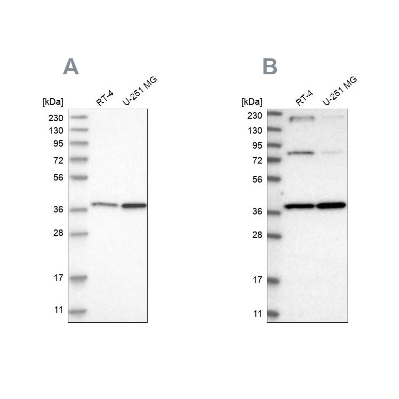MECR Antibody - BSA Free Western Blot: MECR Antibody - BSA Free [NBP1-85657]