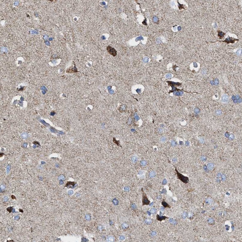 MECR Antibody - BSA Free Immunohistochemistry-Paraffin: MECR Antibody - BSA Free [NBP1-85658]