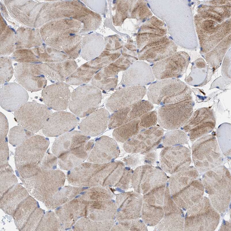 MECR Antibody - BSA Free Immunohistochemistry-Paraffin: MECR Antibody - BSA Free [NBP1-85658]