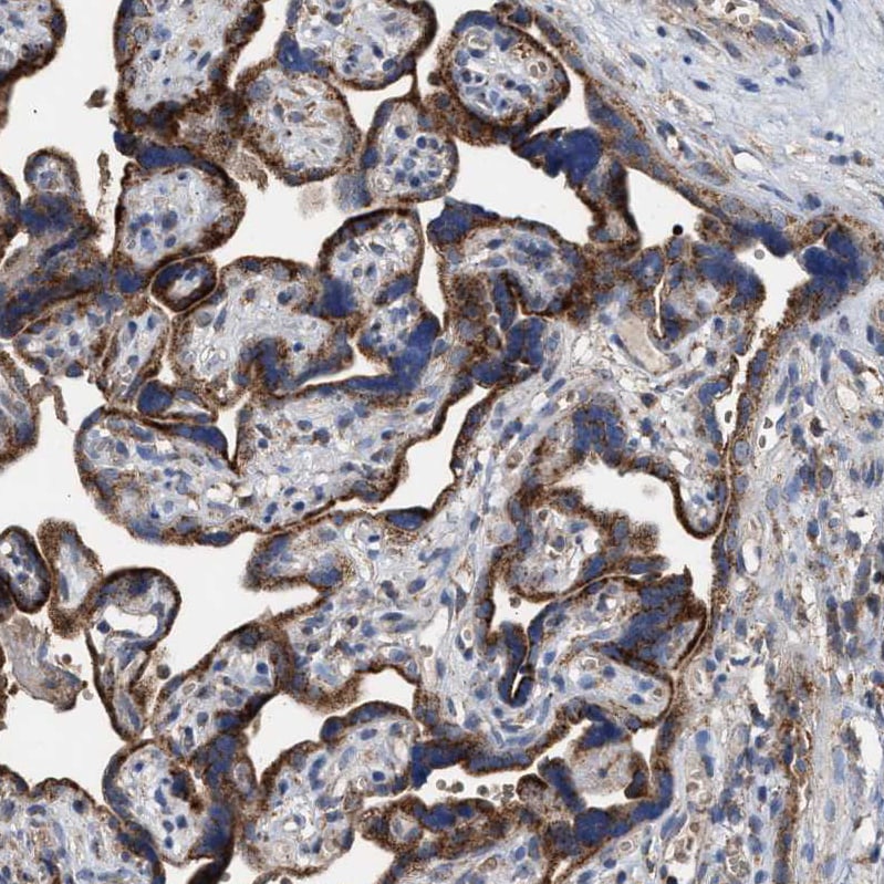 MECR Antibody - BSA Free Immunohistochemistry-Paraffin: MECR Antibody - BSA Free [NBP1-85659]