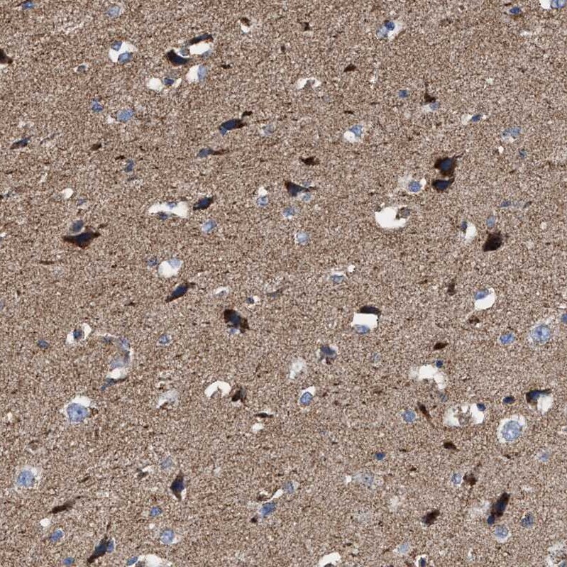 MECR Antibody - BSA Free Immunohistochemistry-Paraffin: MECR Antibody - BSA Free [NBP1-85659]