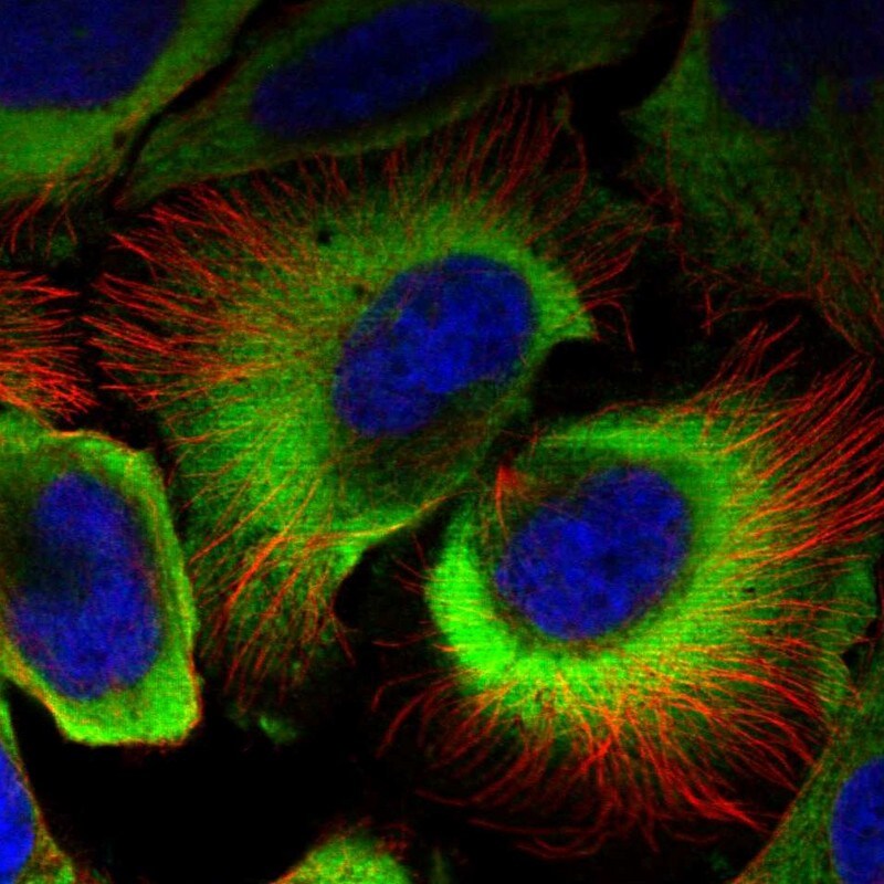 SERBP1 Antibody - BSA Free Immunocytochemistry/ Immunofluorescence: SERBP1 Antibody [NBP1-85660]