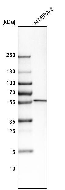 SERBP1 Antibody - BSA Free Western Blot: SERBP1 Antibody - BSA Free [NBP1-85660]