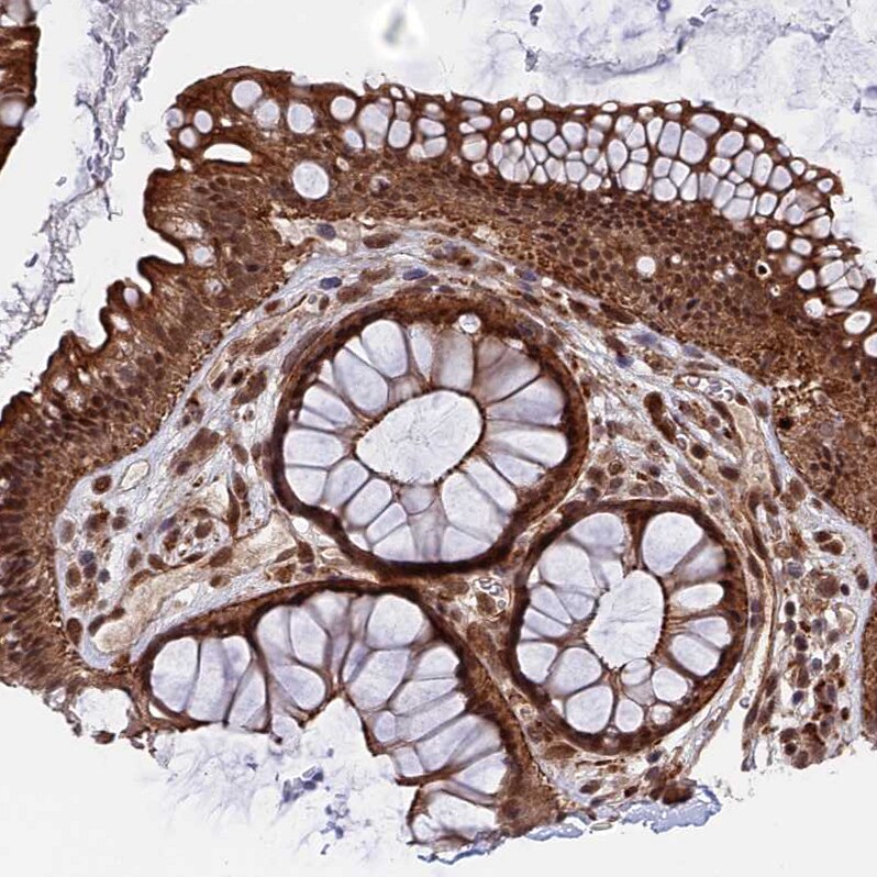 NOSIP Antibody - BSA Free Immunohistochemistry-Paraffin: NOSIP Antibody - BSA Free [NBP1-85661]