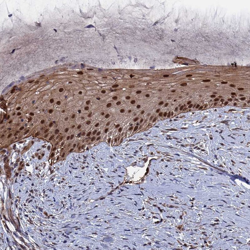 NOSIP Antibody - BSA Free Immunohistochemistry-Paraffin: NOSIP Antibody - BSA Free [NBP1-85661]