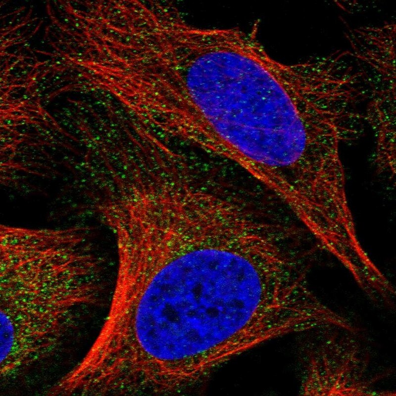 TPRKB Antibody - BSA Free Immunocytochemistry/ Immunofluorescence: TPRKB Antibody [NBP1-85665]