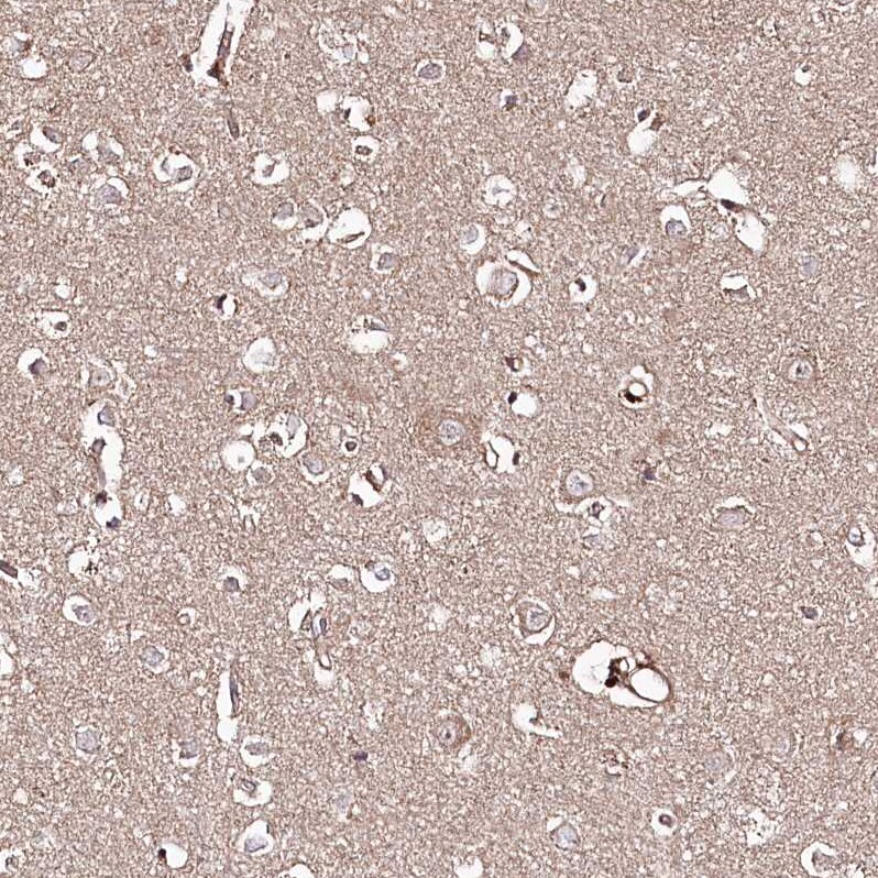 REXO2 Antibody - BSA Free Immunohistochemistry-Paraffin: REXO2 Antibody - BSA Free [NBP1-85666]