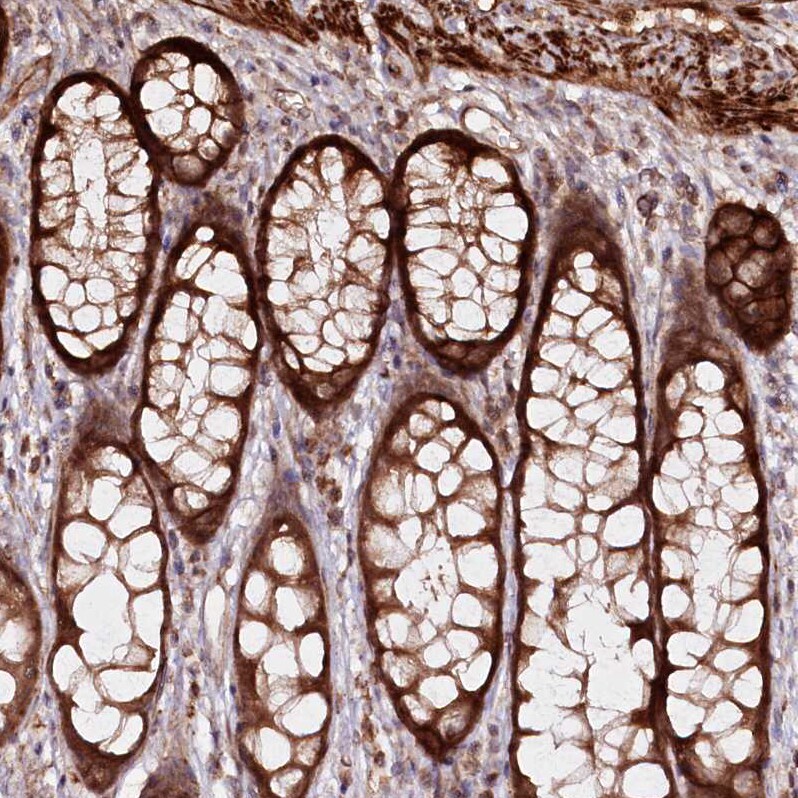 REXO2 Antibody - BSA Free Immunohistochemistry-Paraffin: REXO2 Antibody - BSA Free [NBP1-85666]