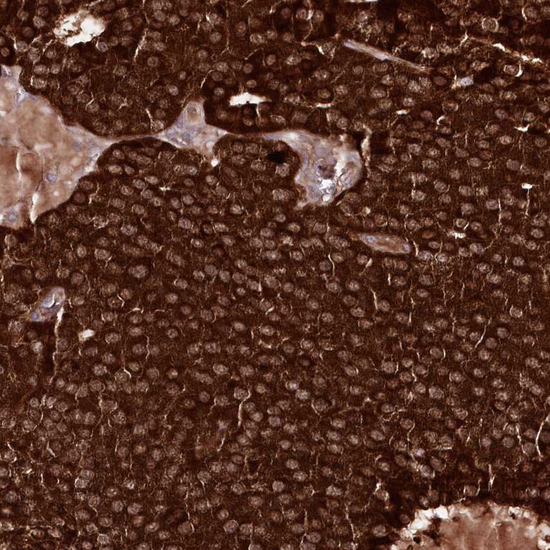 REXO2 Antibody - BSA Free Immunohistochemistry-Paraffin: REXO2 Antibody - BSA Free [NBP1-85666]