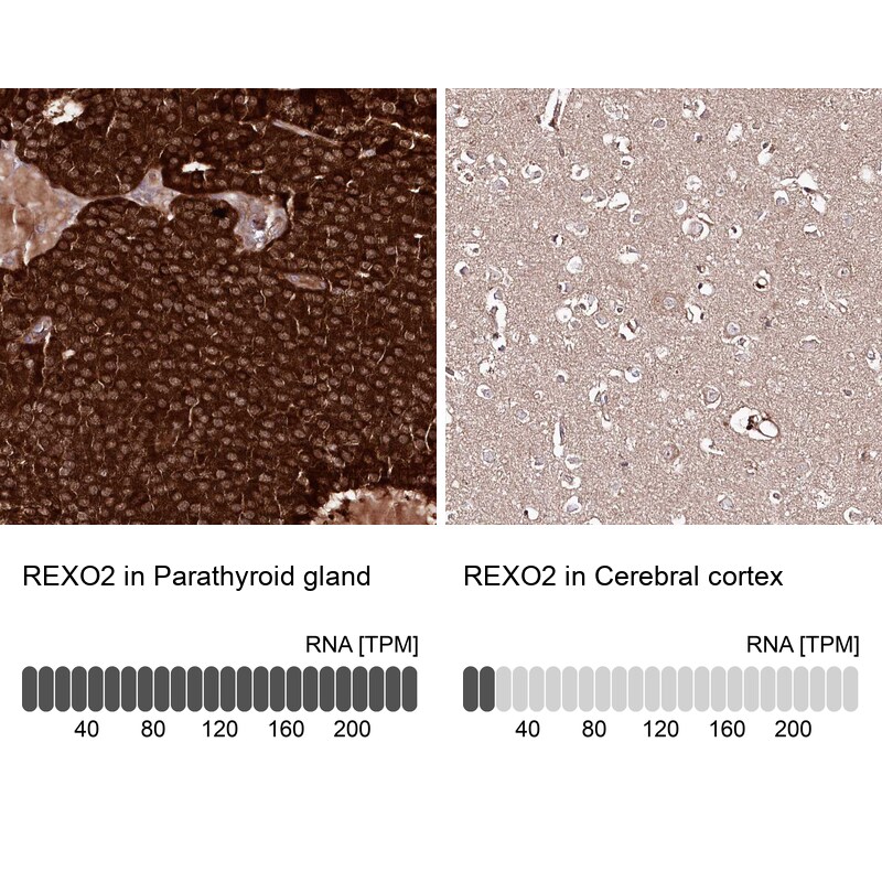 REXO2 Antibody - BSA Free Immunohistochemistry-Paraffin: REXO2 Antibody - BSA Free [NBP1-85666]