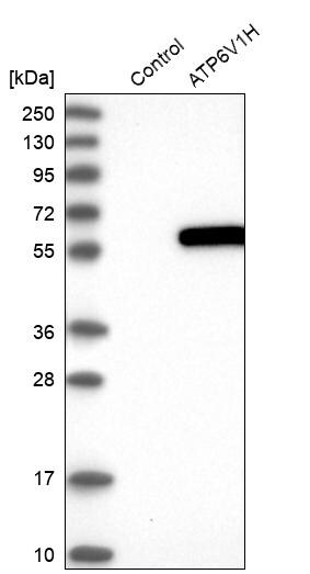 ATP6V1H Antibody - BSA Free Western Blot: ATP6V1H Antibody - BSA Free [NBP1-85668]
