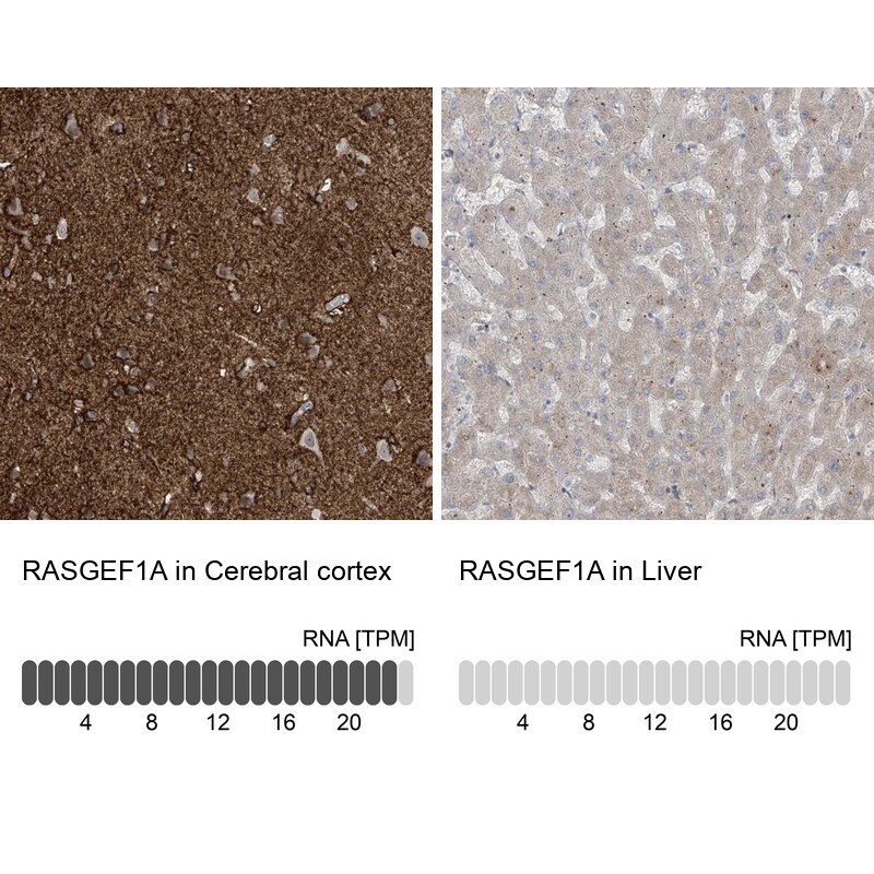 RASGEF1A Antibody - BSA Free Immunohistochemistry-Paraffin: RASGEF1A Antibody [NBP1-85670]