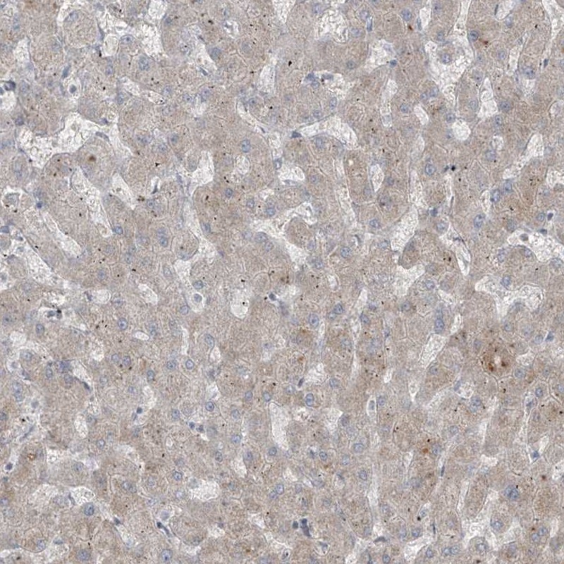 RASGEF1A Antibody - BSA Free Immunohistochemistry-Paraffin: RASGEF1A Antibody [NBP1-85670]