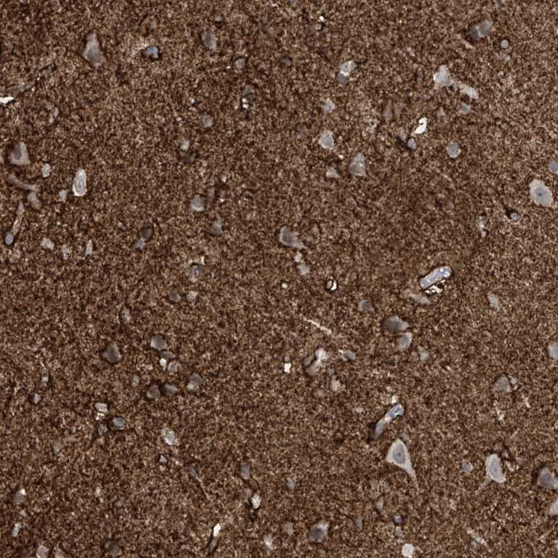 RASGEF1A Antibody - BSA Free Immunohistochemistry-Paraffin: RASGEF1A Antibody [NBP1-85670]