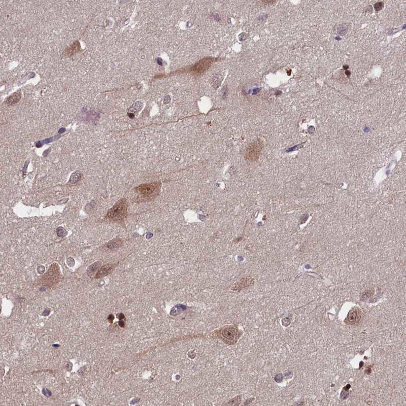 CKAP1 Antibody - BSA Free Immunohistochemistry-Paraffin: CKAP1 Antibody [NBP1-85672]