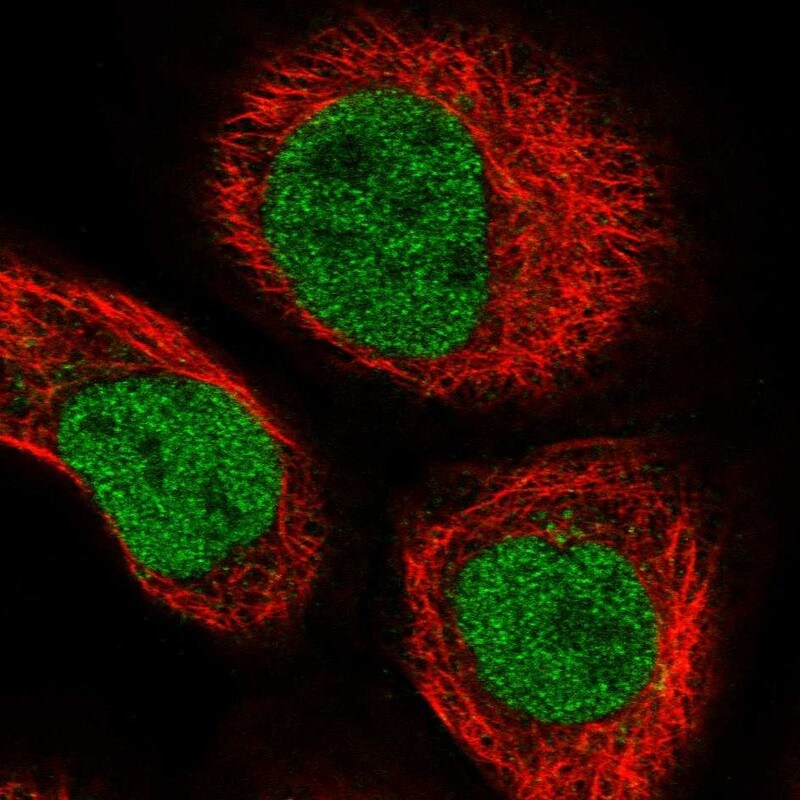 ZNHIT1 Antibody - BSA Free Immunocytochemistry/ Immunofluorescence: ZNHIT1 Antibody - BSA Free [NBP1-85673]