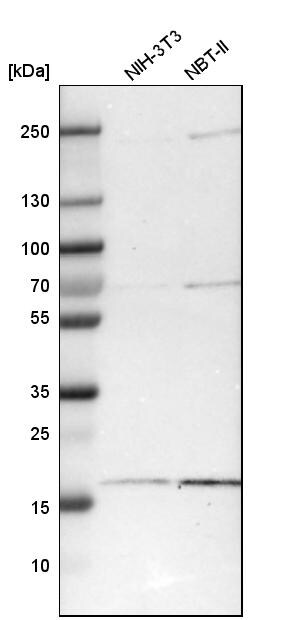 ZNHIT1 Antibody - BSA Free Western Blot: ZNHIT1 Antibody - BSA Free [NBP1-85673]