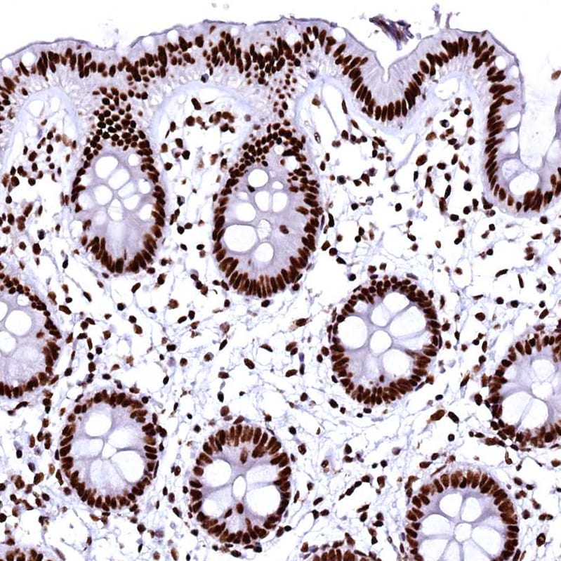 CPSF6 Antibody - BSA Free Immunohistochemistry-Paraffin: CPSF6 Antibody - BSA Free [NBP1-85676]
