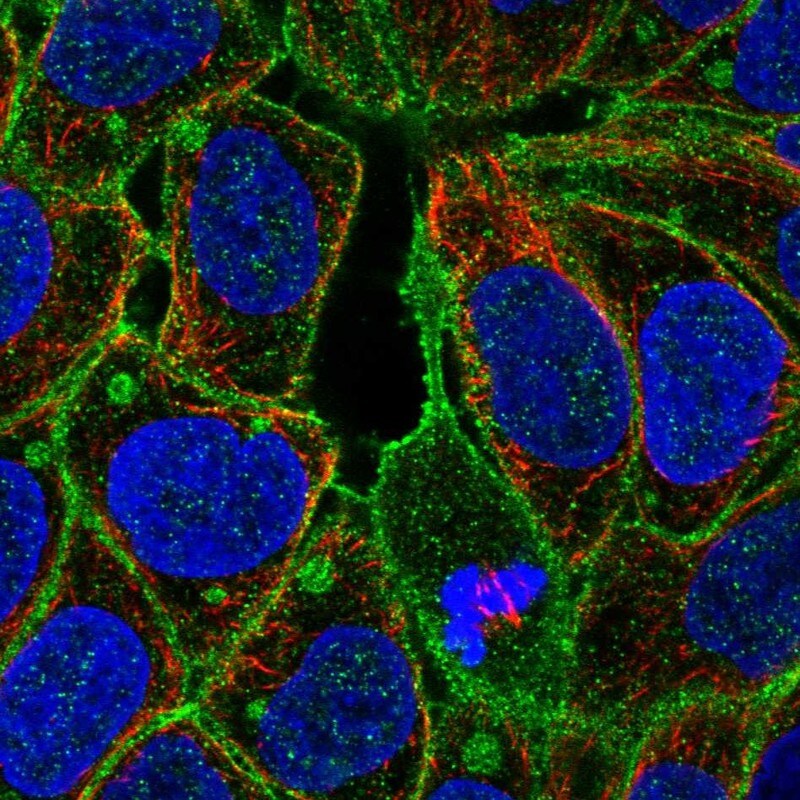 Fgr Antibody - BSA Free Immunocytochemistry/ Immunofluorescence: Fgr Antibody [NBP1-85677]