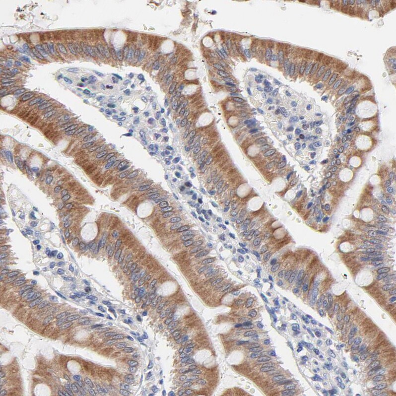 AADAC Antibody - BSA Free Immunohistochemistry-Paraffin: AADAC Antibody - BSA Free [NBP1-85680]