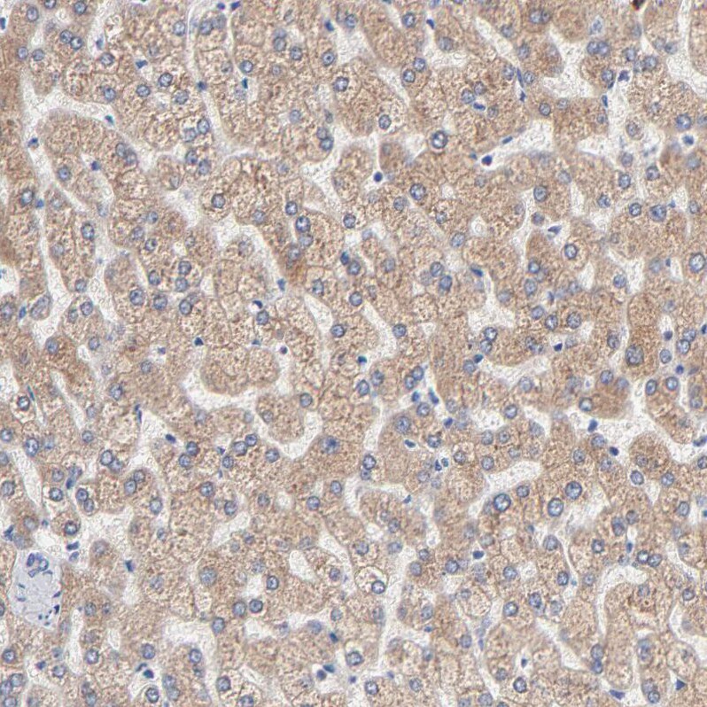 AADAC Antibody - BSA Free Immunohistochemistry-Paraffin: AADAC Antibody - BSA Free [NBP1-85680]