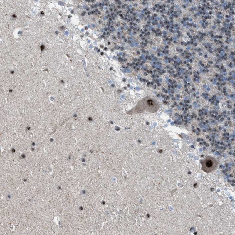 CENPP Antibody - BSA Free Immunohistochemistry-Paraffin: CENPP Antibody [NBP1-85688]