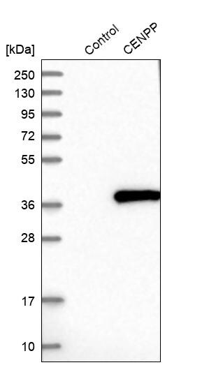 CENPP Antibody - BSA Free Western Blot: CENPP Antibody - BSA Free [NBP1-85688]