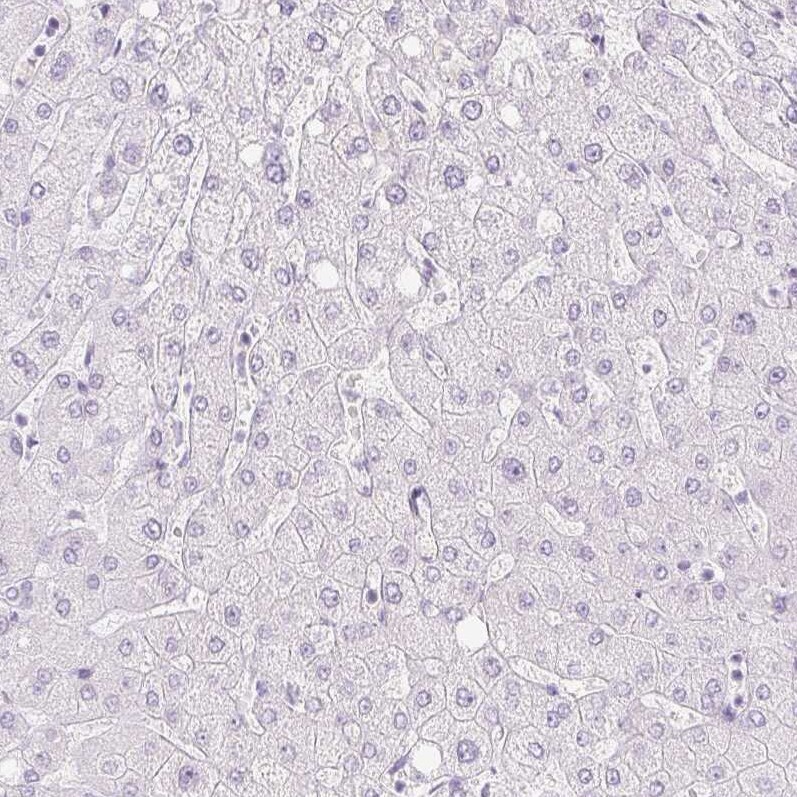 Trappin-2/Elafin/Skalp Antibody - BSA Free Immunohistochemistry-Paraffin: Trappin-2/Elafin/Skalp Antibody [NBP1-85690]