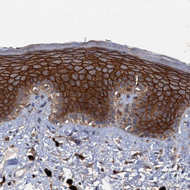 SCUBE3 Antibody - BSA Free Immunohistochemistry-Paraffin: SCUBE3 Antibody - BSA Free [NBP1-85692]