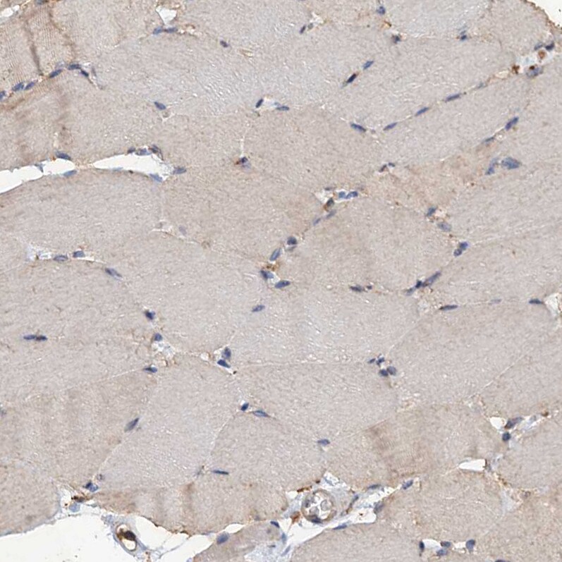 SCUBE3 Antibody - BSA Free Immunohistochemistry-Paraffin: SCUBE3 Antibody - BSA Free [NBP1-85692]