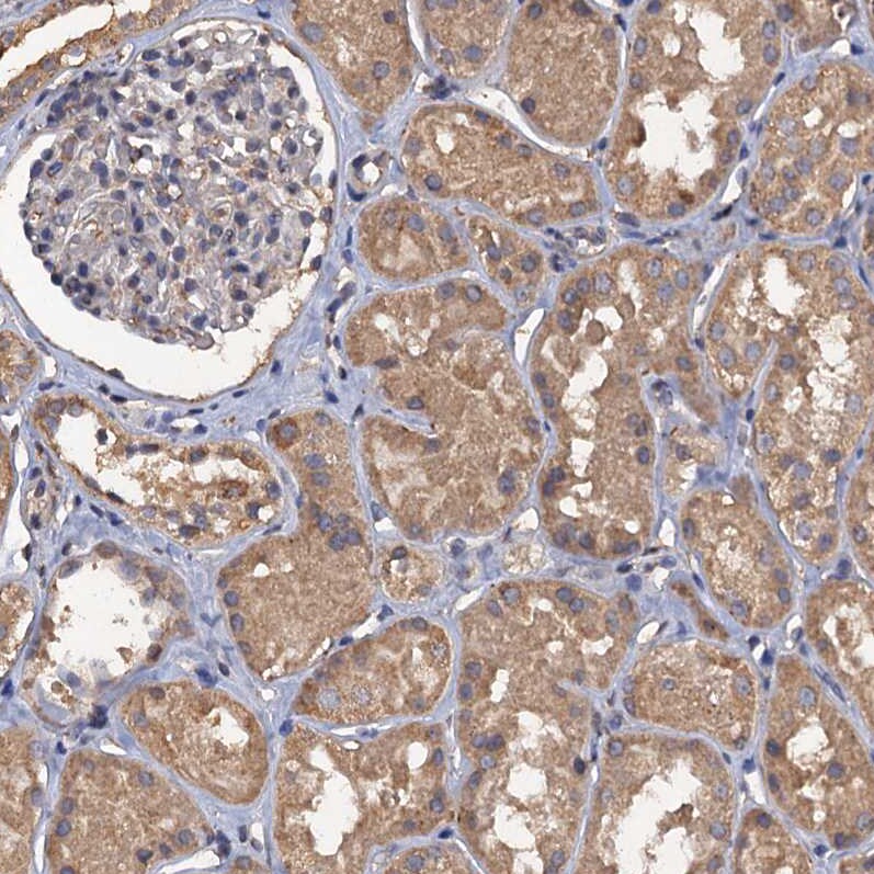 SCUBE3 Antibody - BSA Free Immunohistochemistry-Paraffin: SCUBE3 Antibody - BSA Free [NBP1-85692]