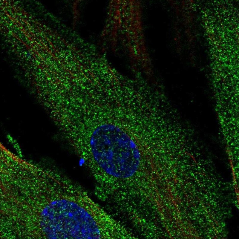 SCUBE3 Antibody - BSA Free Immunocytochemistry/ Immunofluorescence: SCUBE3 Antibody - BSA Free [NBP1-85692]