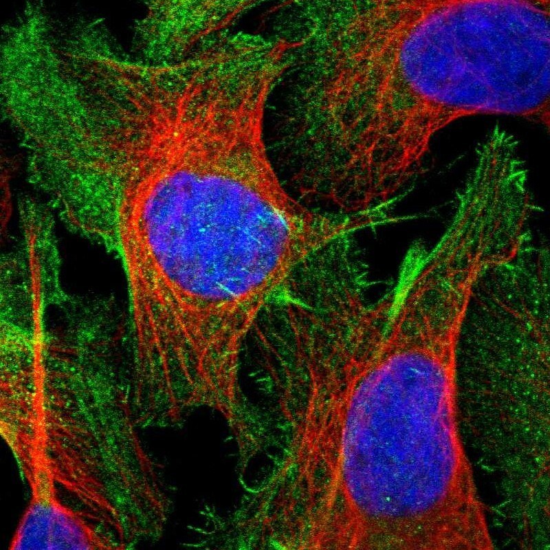Caldesmon/CALD1 Antibody - BSA Free Immunocytochemistry/ Immunofluorescence: Analysis in human prostate and skeletal muscle tissues using NBP1-85701 antibody. Corresponding CALD1 RNA-seq data are presented for the same tissues.
