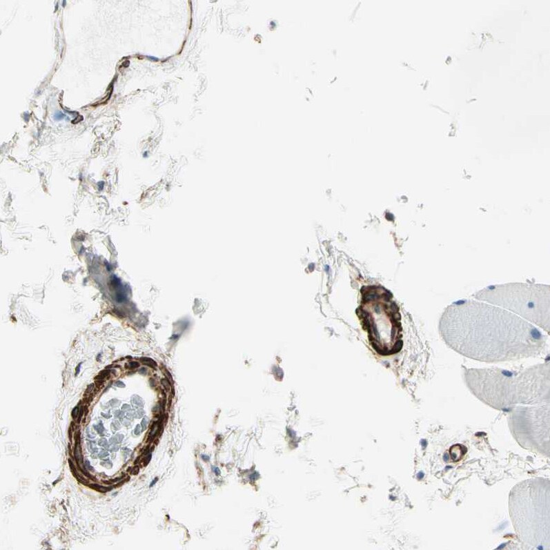Caldesmon/CALD1 Antibody - BSA Free Immunohistochemistry-Paraffin: Caldesmon/CALD1 Antibody - BSA Free [NBP1-85702]