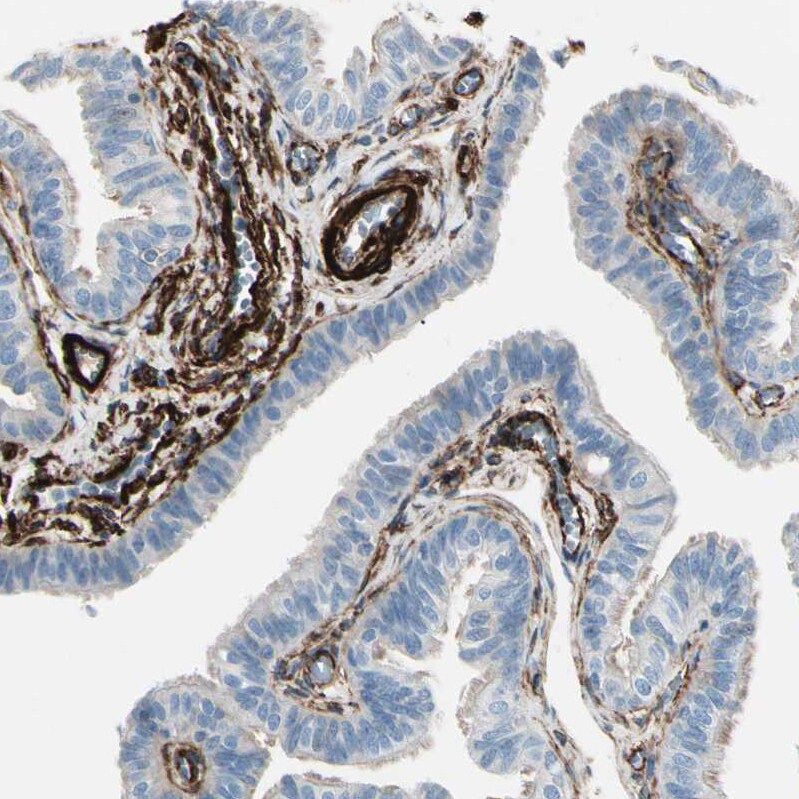 Caldesmon/CALD1 Antibody - BSA Free Immunohistochemistry-Paraffin: Caldesmon/CALD1 Antibody - BSA Free [NBP1-85702]