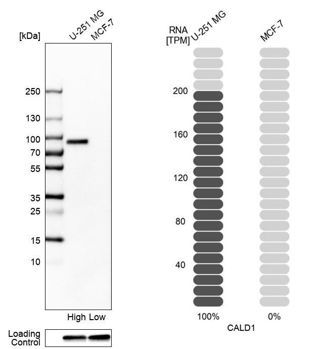 Caldesmon/CALD1 Antibody - BSA Free Western Blot: Caldesmon/CALD1 Antibody - BSA Free [NBP1-85702]