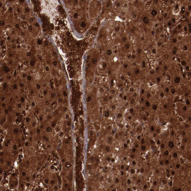 FTSJ1 Antibody - BSA Free Immunohistochemistry-Paraffin: FTSJ1 Antibody [NBP1-85703]